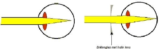 bijziend1
