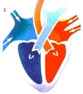 hart31